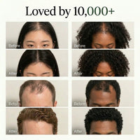 The Korean Scalp Revival Bar 5